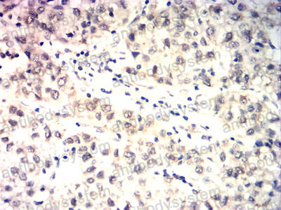 Валидация AntibodySystem RHG42207 (2930)