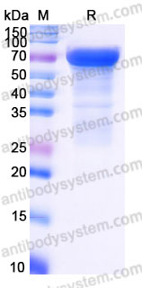 AHC34201, SDS-PAGE