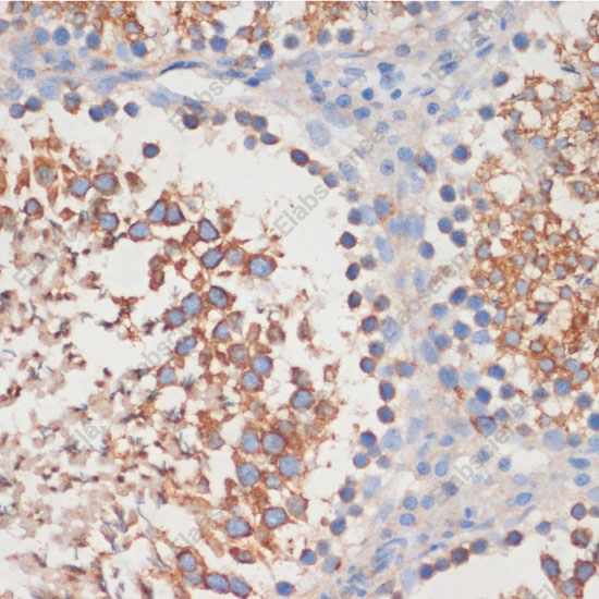Иммуногистохимия, CDC42, ткань семенника крысы