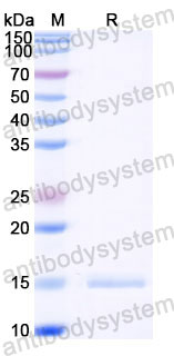 Валидация SDS-PAGE - AntibodySystem RZZ01806