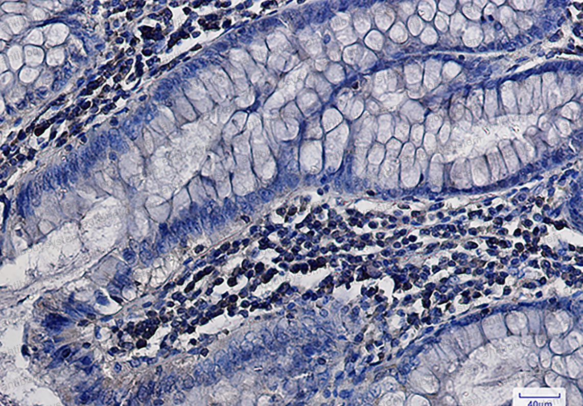 Валидация AntibodySystem RHF95509