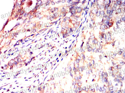 Валидация AntibodySystem RHD74902 (1791)