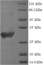 SDS-PAGE