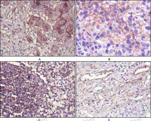 Валидация AntibodySystem RHD46602