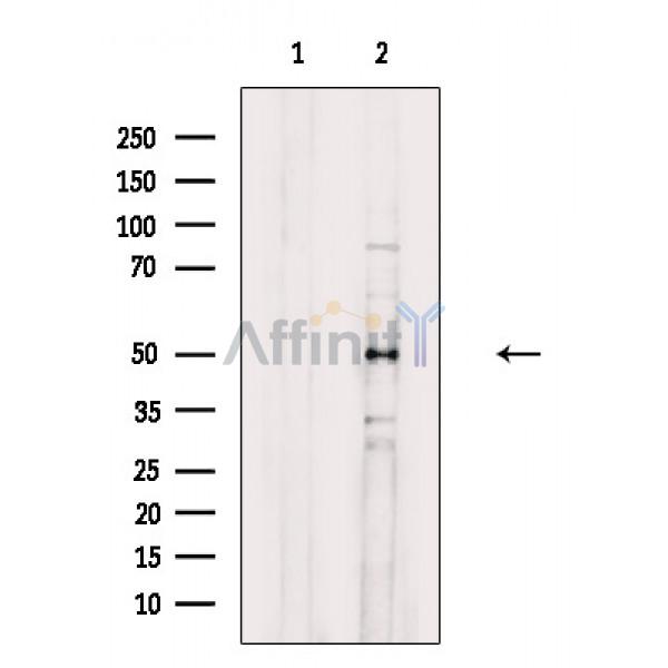 Валидация Affinity DF8542 - 20427