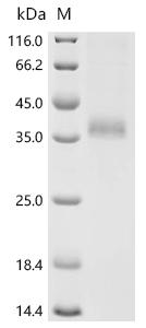 SDS-PAGE