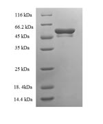 SDS-PAGE