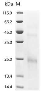 SDS-PAGE