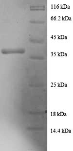 SDS-PAGE