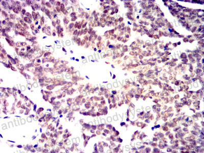 Валидация AntibodySystem RHE73903 (2300)