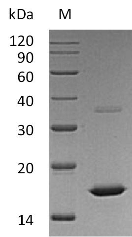 SDS-PAGE