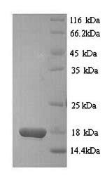 SDS-PAGE
