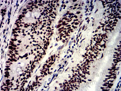 Валидация AntibodySystem RHE91302