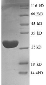 SDS-PAGE