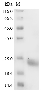 SDS-PAGE