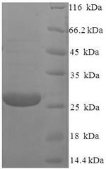 SDS-PAGE