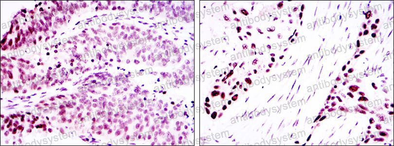 Валидация AntibodySystem RHJ56403