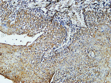 Валидация AntibodySystem RHB95907