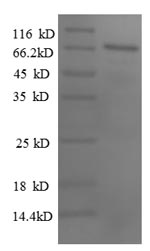 SDS-PAGE