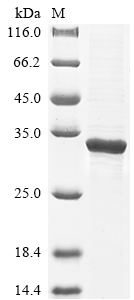 SDS-PAGE