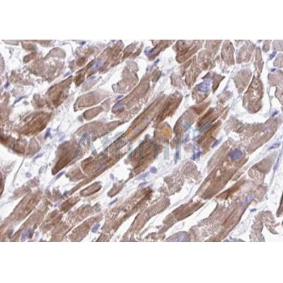 Валидация Affinity AF5203 - 2656