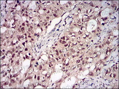 Валидация AntibodySystem RHF48403 (2536)