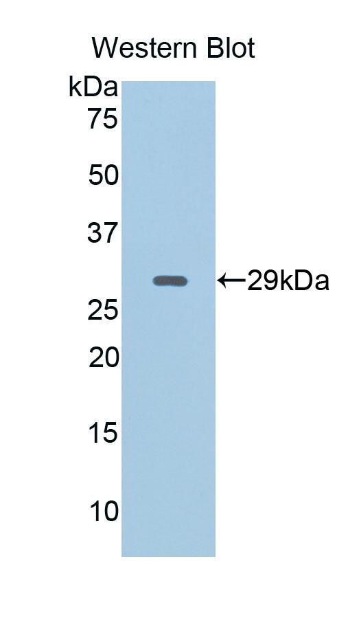 38963