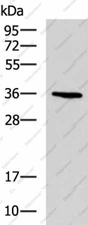 Вестерн-блоттинг, BDNF, клетки A549
