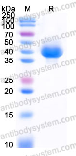 AHH02201, SDS-PAGE