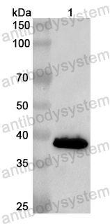 Валидация AntibodySystem PHB40601