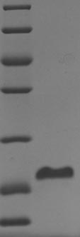 SDS-PAGE