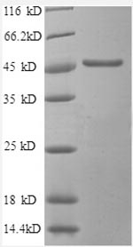SDS-PAGE