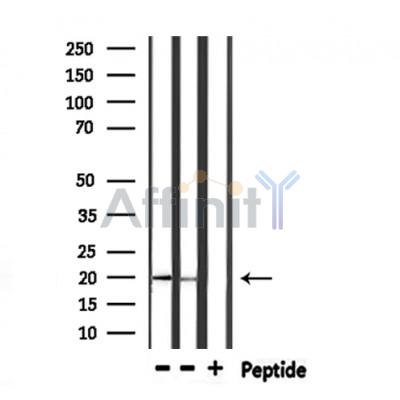 Валидация Affinity DF6604 - 18054