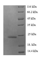 SDS-PAGE