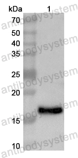 Валидация AntibodySystem PHB77301