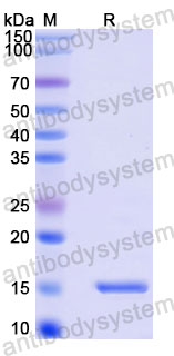 Валидация SDS-PAGE - AntibodySystem RVV30602