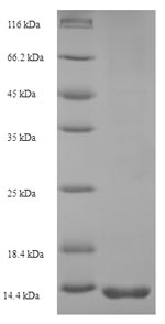 SDS-PAGE