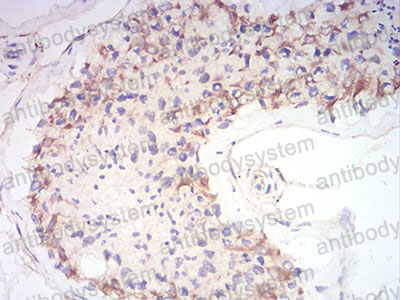 Валидация AntibodySystem RHD25003