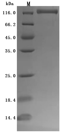 SDS-PAGE