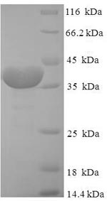 SDS-PAGE
