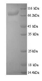 SDS-PAGE