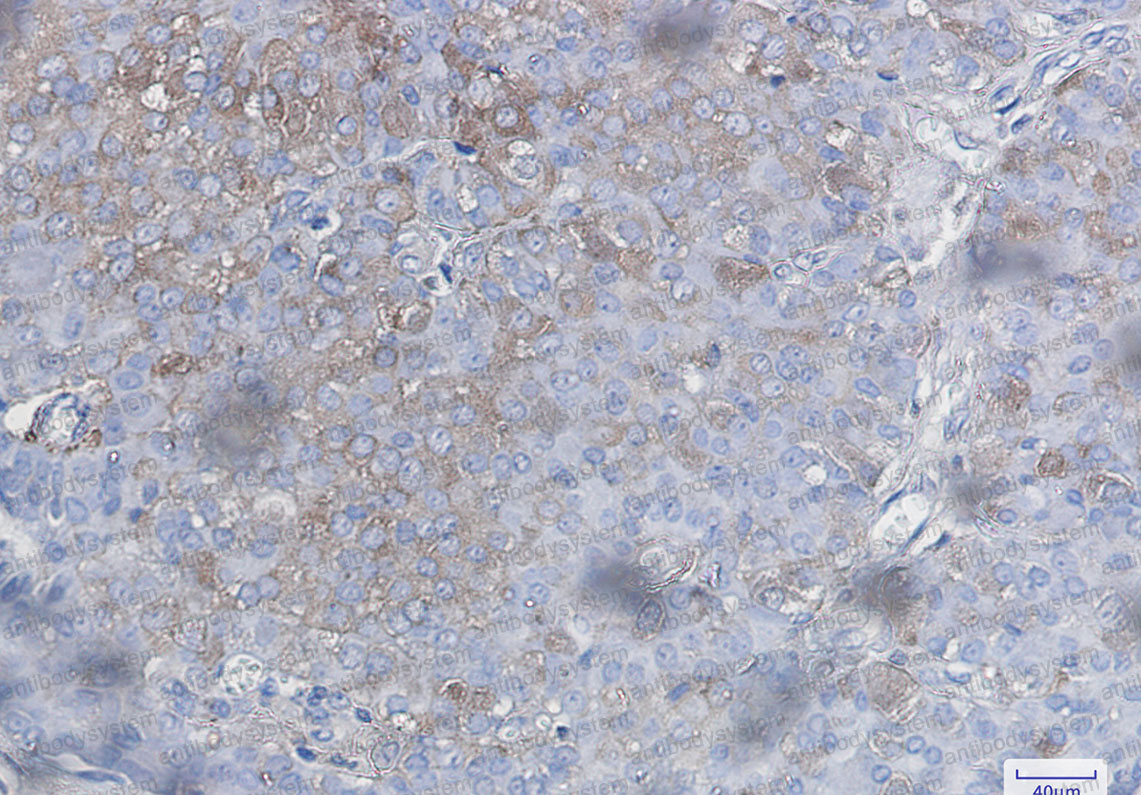 Валидация AntibodySystem RHJ34801