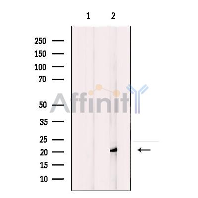 Валидация Affinity DF12143 - 6324