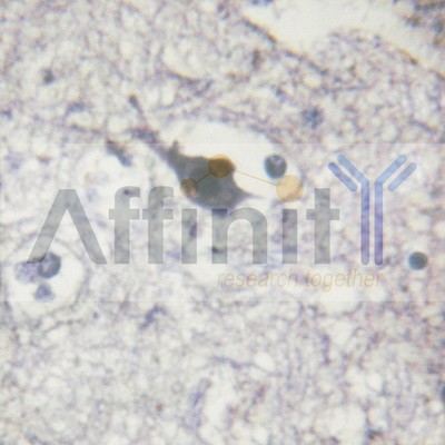 Валидация Affinity AF6124 - 3341