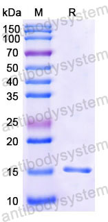 Валидация SDS-PAGE - AntibodySystem RHD06901