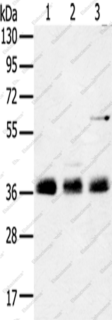 Вестерн-блоттинг, ANKRD1, ткань легкого мыши и клеточные линии NIH/3T3 и HepG2