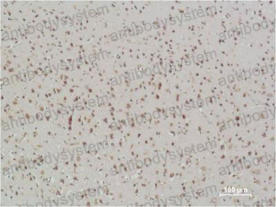 Валидация AntibodySystem RHG01007 (2785)