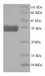 SDS-PAGE