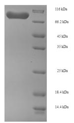 SDS-PAGE