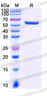 EHC04401, SDS-PAGE